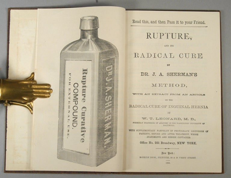 Item #87052 RUPTURE, and ITS RADICAL CURE. J. A. SHERMAN.