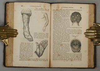PORNEIOPATHOLOGY: A POPULAR TREATISE ON VENEREAL AND OTHER DISEASES